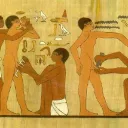 Circuncisión.
