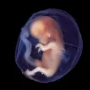 Una epidemia silenciosa