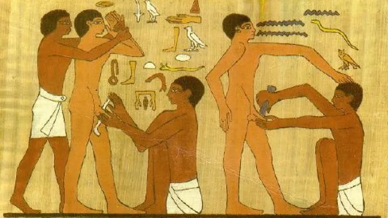 Circuncisión.