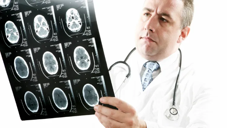 A doctor holding an xray.