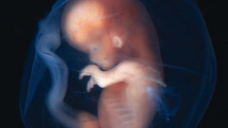 Abortar Abortar