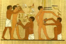 Circuncisión.