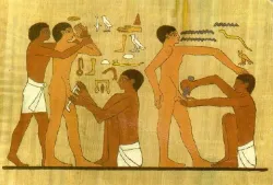 Circuncisión.
