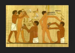 Circuncisión